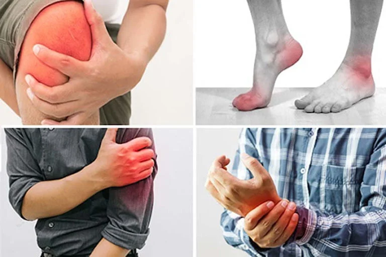 Thoái hóa khớp